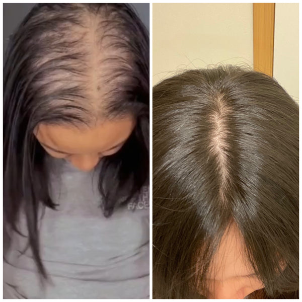 Shampoo Elisir di Crescita